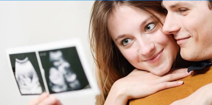 Futuros pais olham para uma foto de um ultrassom