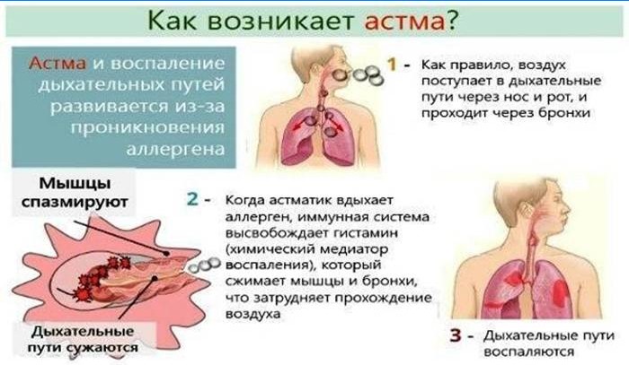 Como a asma ocorre?