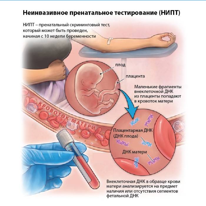 Teste pré-natal não invasivo (NIPT)
