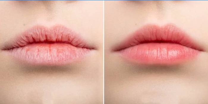 Lábios antes e depois de aplicar o bálsamo